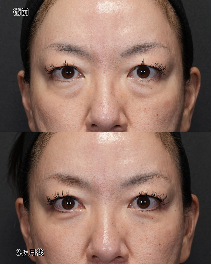 裏ハムラ 40代女性