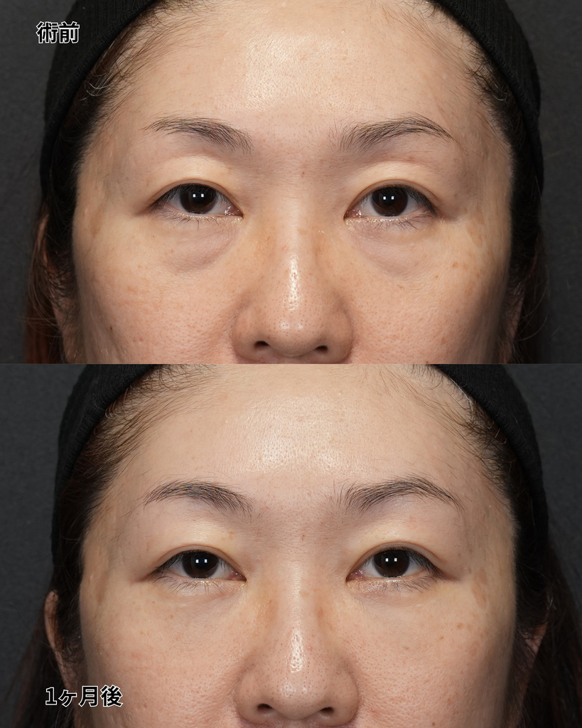 裏ハムラ 40代女性