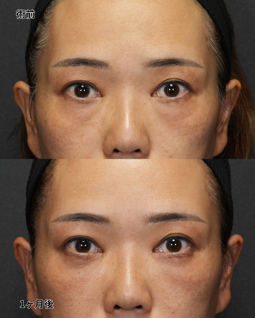 裏ハムラ 40代女性