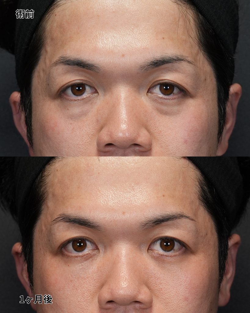 裏ハムラ 30代男性