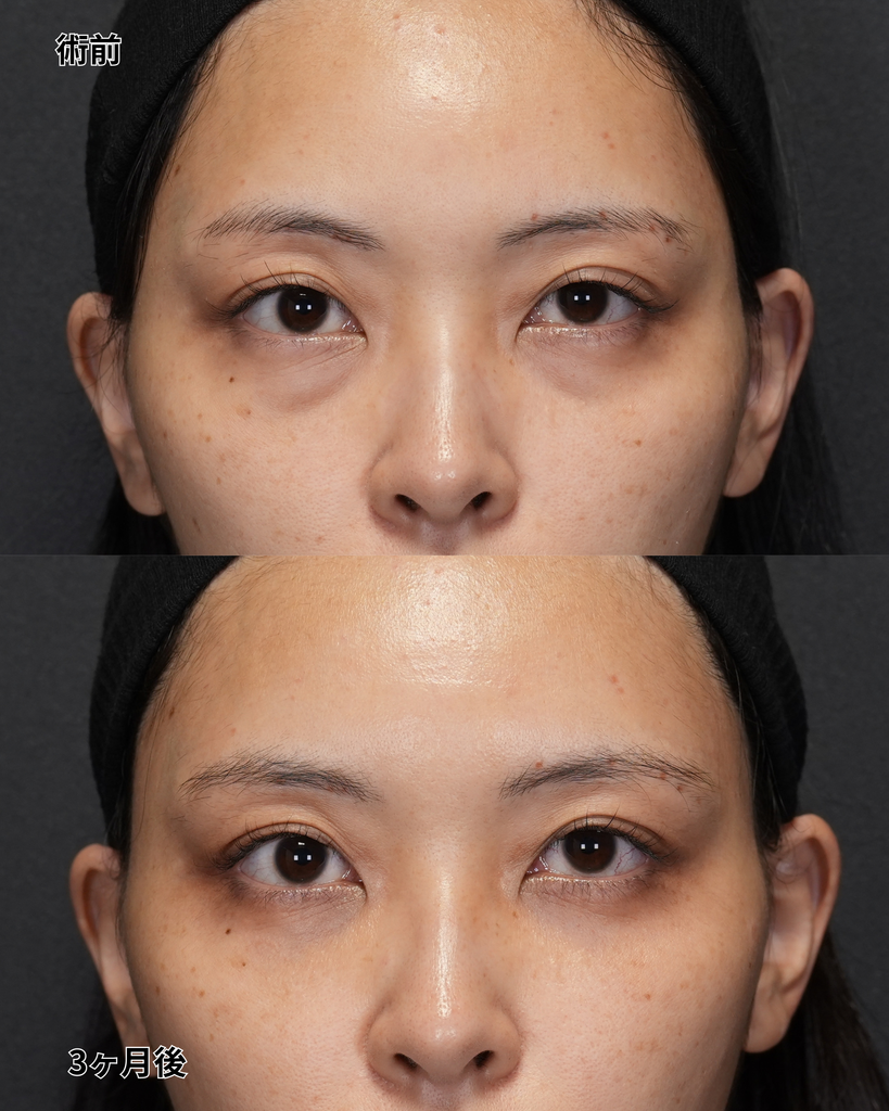 裏ハムラ 30代女性
