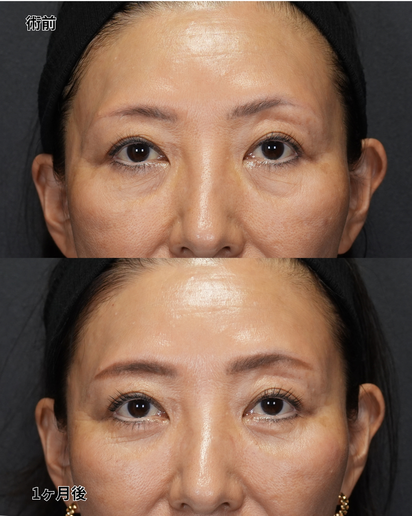 表ハムラ 50代女性