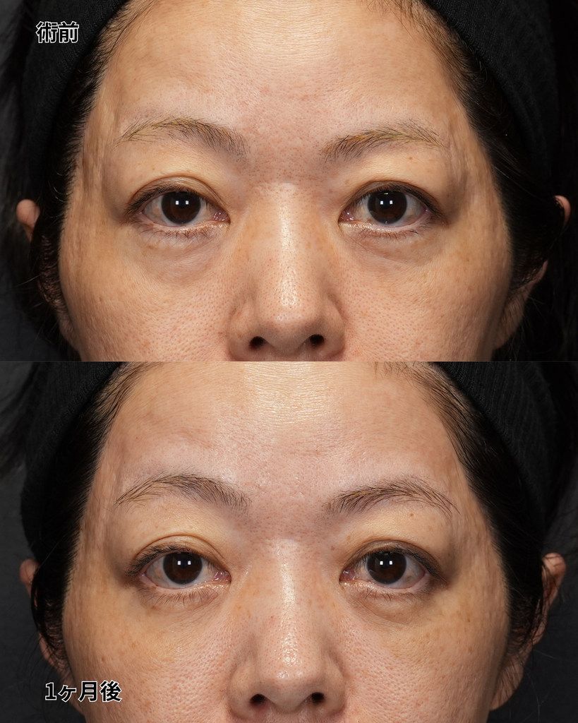 裏ハムラ 50代女性
